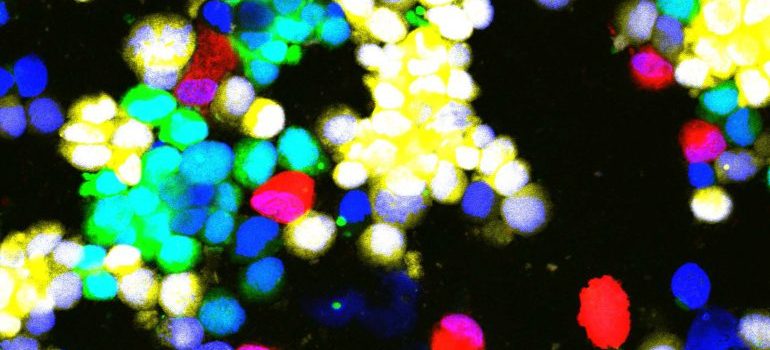 Fluorescent Labeled Retinal Cells in Suspension