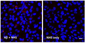 Amyloid beta Induced Membrane Attack Complex (MAC) Formation on RPE Cells
