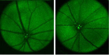Imaging AD Mouse Retina with fSLO