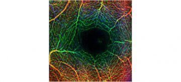 Human Retinal Microvasculature